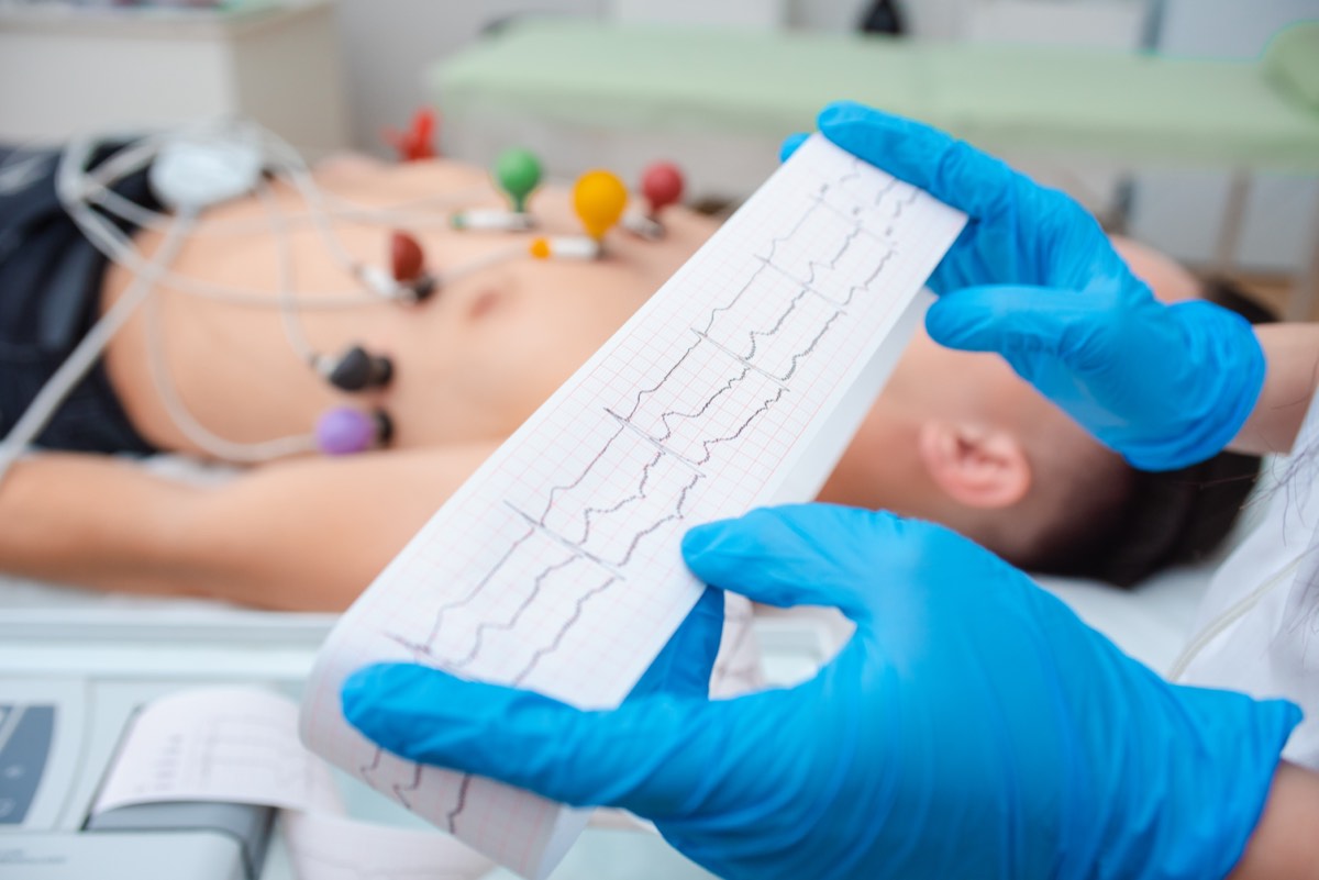 Clinician reviewing an EKG printout during a cardiac test